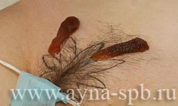 Интимные стрижки: фото женских и мужских интим-причесок
